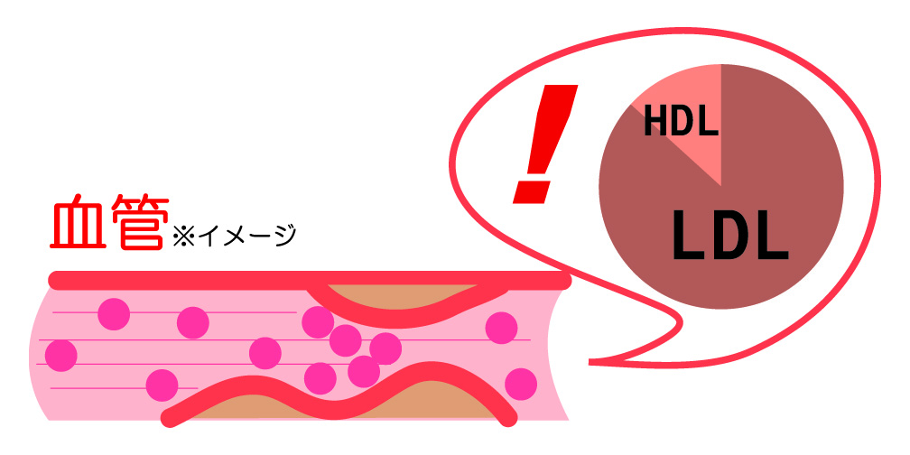脂質異常症