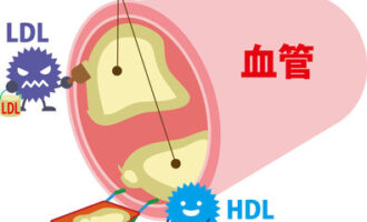 コレステロール
