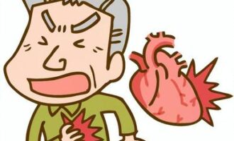 心筋梗塞